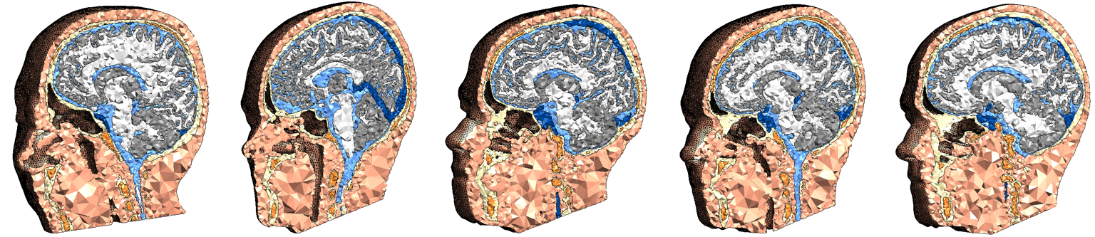 SimNIBS Group Dataset image